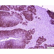 Tissue Control Slide, HPV for IHC